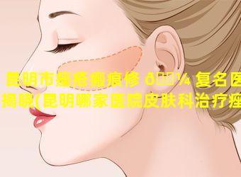 昆明市痤疮瘢痕修 🌼 复名医榜揭晓(昆明哪家医院皮肤科治疗痤疮好)